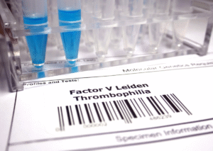 פקטור 5 ליידן